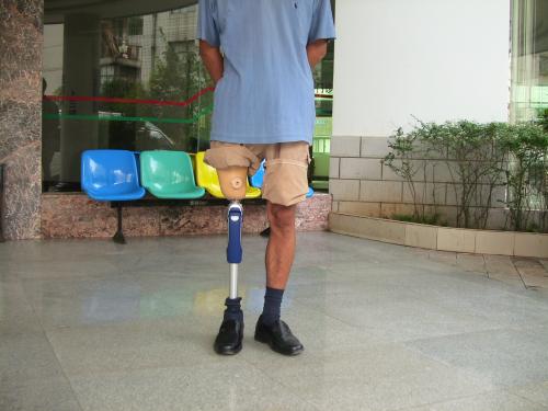 一個好的假肢廠家從哪些方面進行評價(圖1) 一個好的假肢廠家從哪些方面進行評價(圖1)