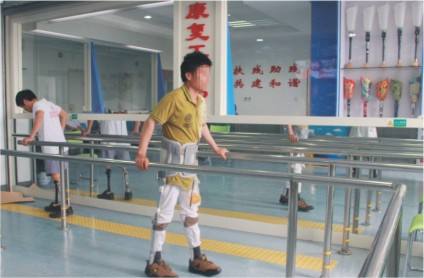 假肢穿戴時(shí)間和假肢價(jià)格有關(guān)系嗎(圖1) 假肢穿戴時(shí)間和假肢價(jià)格有關(guān)系嗎(圖1)