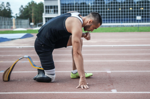 分析假肢價格比較高的原因是什么(圖1) 分析假肢價格比較高的原因是什么(圖1)
