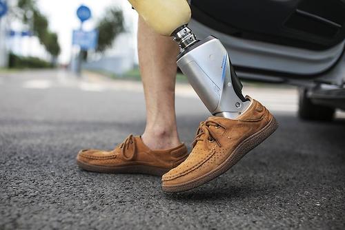 假肢價(jià)格多少錢初次安裝假肢應(yīng)該如何做呢?(圖1) 假肢價(jià)格多少錢初次安裝假肢應(yīng)該如何做呢?(圖1)