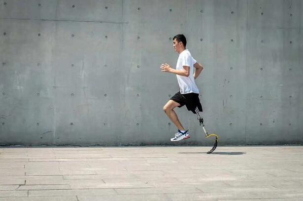 截肢患者必看的安裝假肢所需注意事項(xiàng)(圖2) 假肢