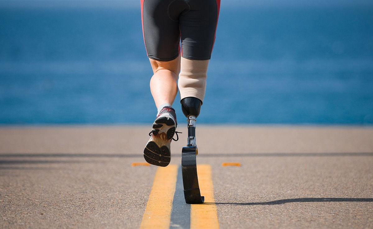 如何將假肢價(jià)格的優(yōu)勢(shì)充分發(fā)揮出來?(圖1) 假肢價(jià)格